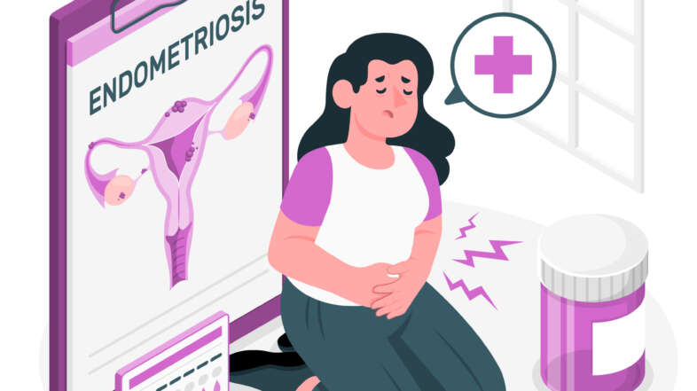 Navigating Life with Endometriosis: Tips, Myths, and Insights